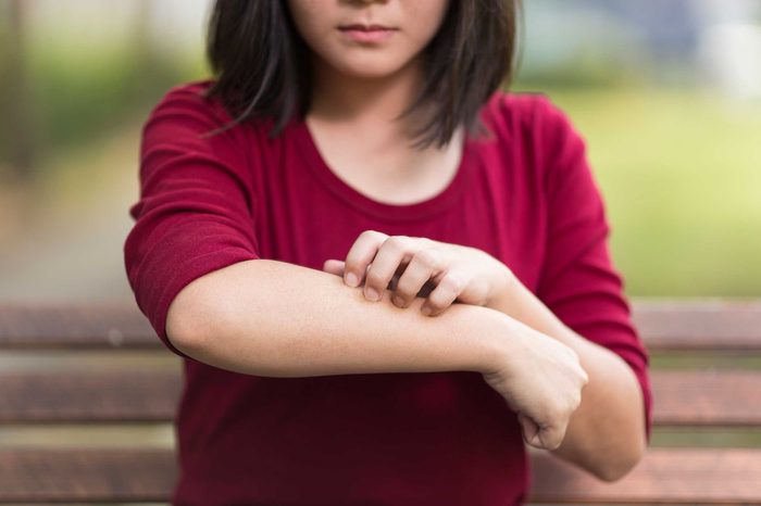 woman scratching her arm