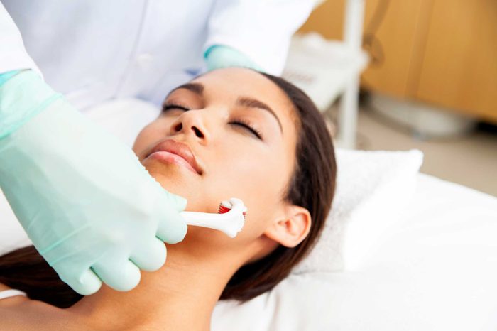 gloved hand microneedling a woman with closed eyes