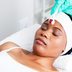 I Tried RF Microneedling: Hereâ€™s What You Need to Know