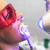 9 Things Dentists Wish You Knew About Teeth Whitening