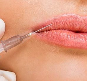 01_lips_do_lip_plumpers
