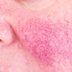 Got Rosacea? These Makeup Tricks Will Make It Disappear