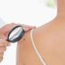 8 Surprising Facts About Skin Cancer