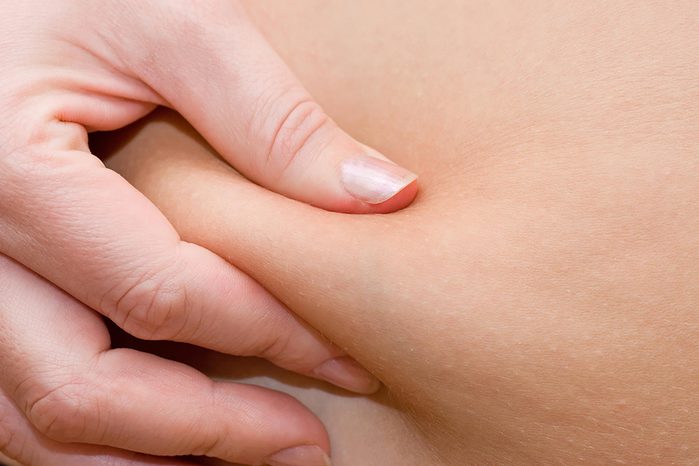 fingers pinching skin