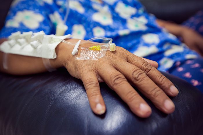 chemotherapy