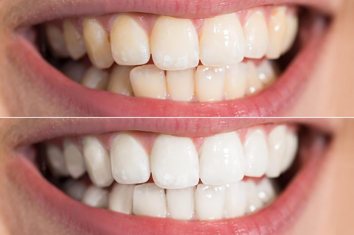 teeth