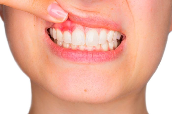Things-Your-Dentist-Wants-You-to-Know-(But-You're-Too-Scared-to-Ask)