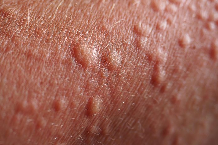close up of hives
