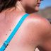 9 Clear Signs Youâ€™ve Gotten Too Much Sun