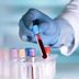 Men with This Blood Type Could Be More Likely to Have a Heart Attack