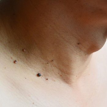Neck