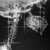 6 Surprising Jaw Pain Causes to Watch Out For
