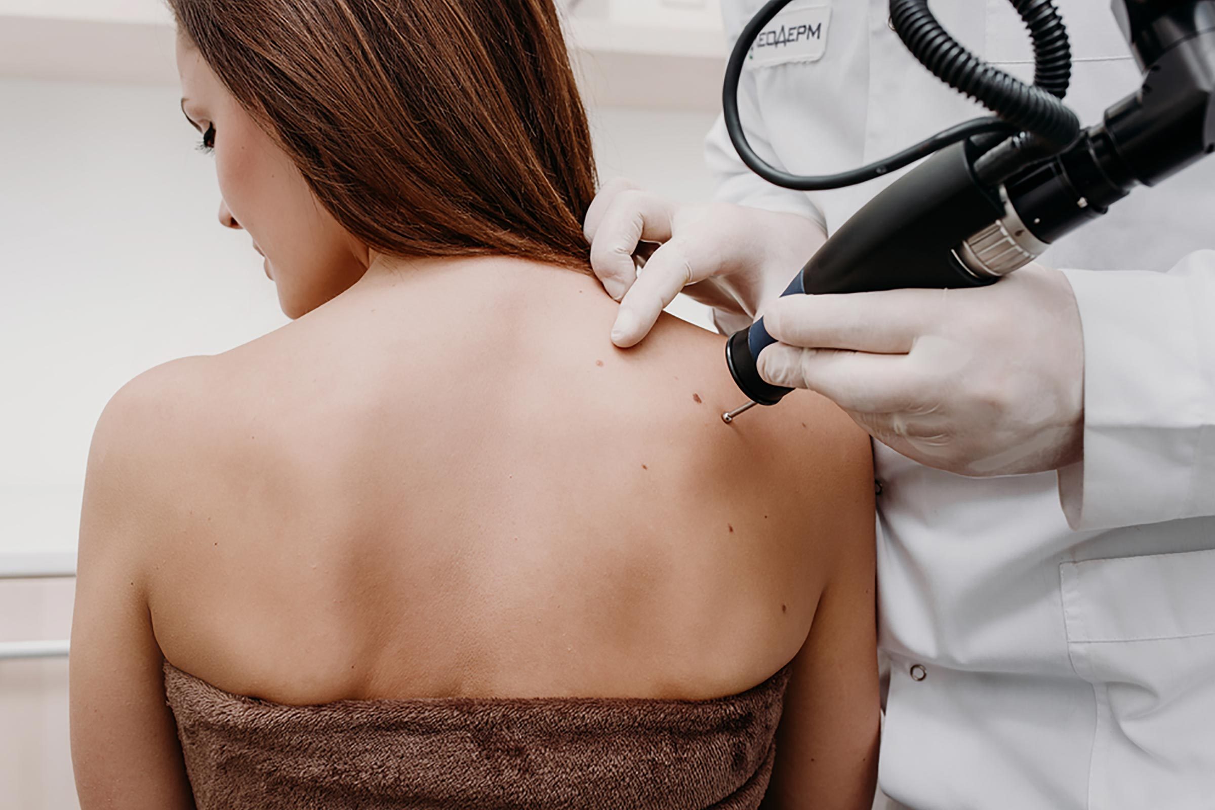skin-tags