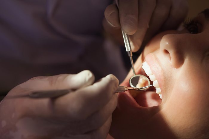 Dentist looking into patient's mouth