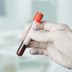 The Blood Type Diet: Does It Really Work?