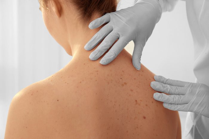 Dermatologist examining patient in clinic, closeup