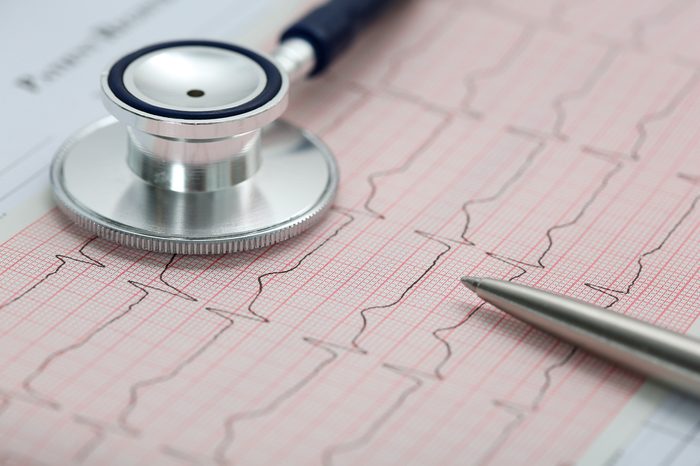Stethoscope head and silver pen lying on cardiogram on clipboard pad