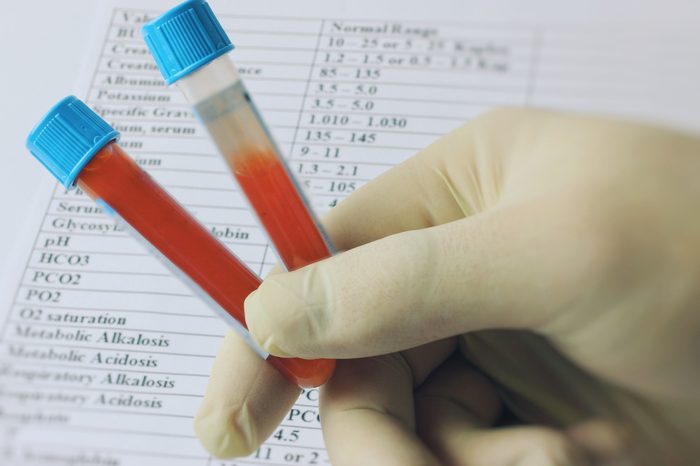 Test tubes with blood in a lab technician's gloved hand