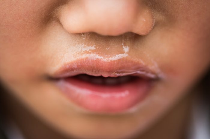 young child with a runny nose