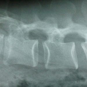 X-ray image of the spinal cord